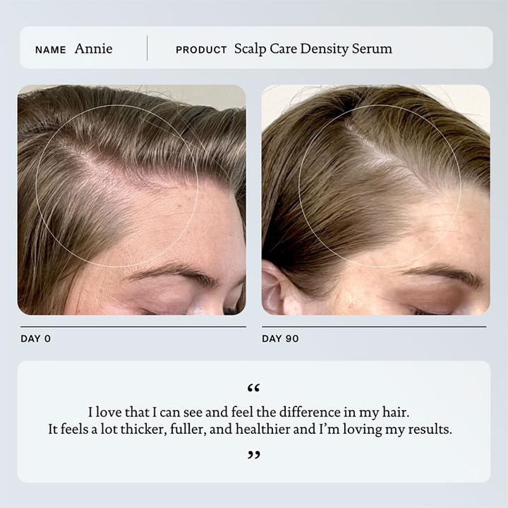 Image du produit Living Proof Scalp Care Density Serum 1.7 Fl Oz (50 ml)