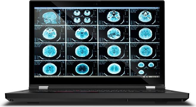 Produktbild Lenovo ThinkPad P15 G1 (15.60", Intel Core i7-10750H, 16 GB, 512 GB, DE)