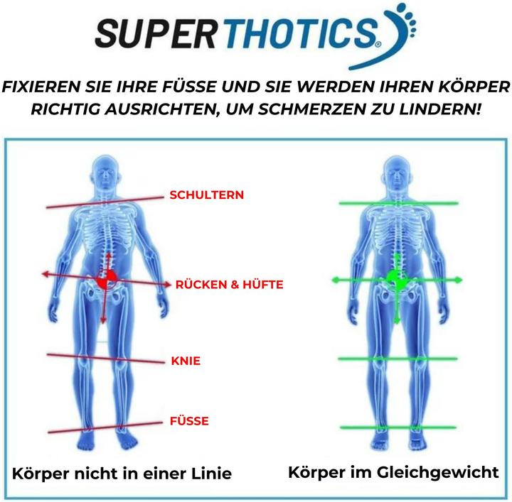 Produktbild Superthotics 