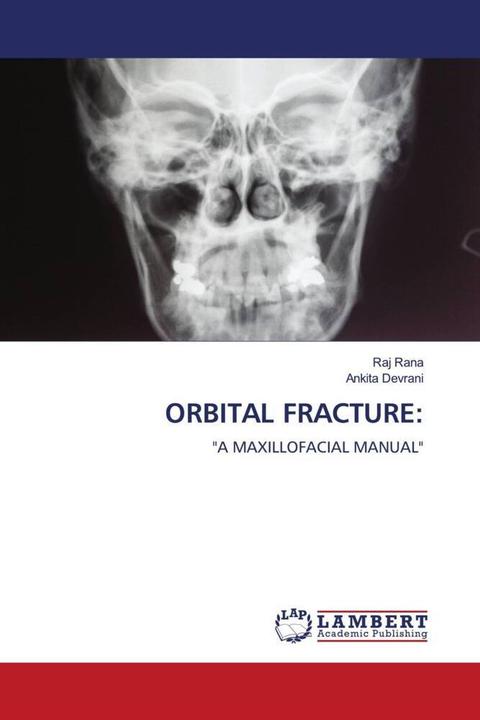 Produktbild Orbital Fracture: (Deutsch, Raj Rana, Ankita Devrani, 2023)