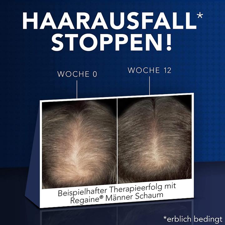 Actual product image Regaine 3x 60ml Hair Growth