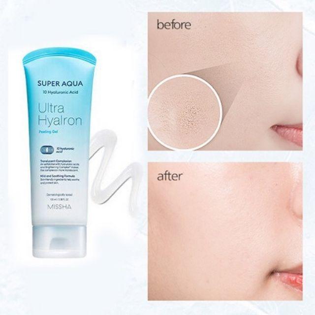 Actual product image Missha Super Aqua (Exfoliation, 100 ml)
