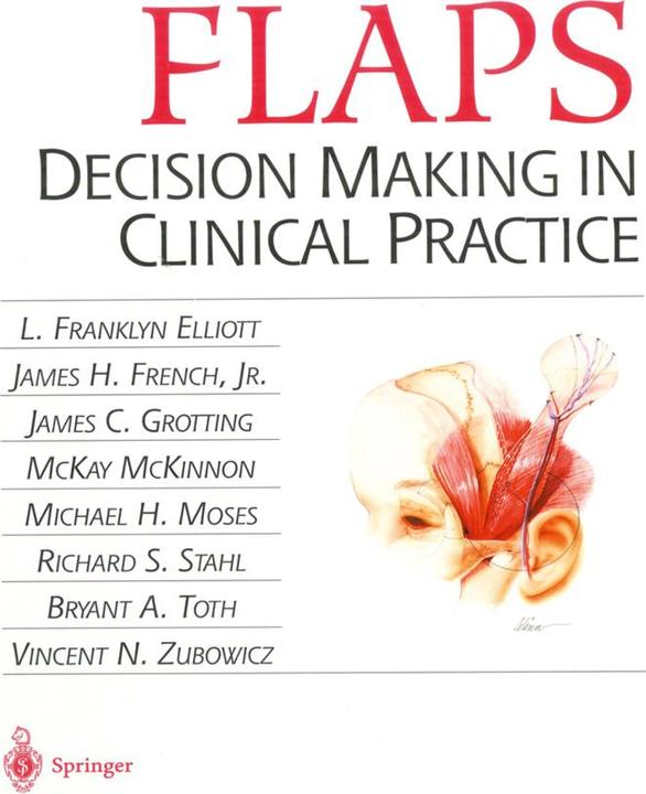 Actual product image Flaps (Michael H. Moses, McKay McKinnon, James H. French, L. Franklyn Elliot, Bryant A. Toth, Richard S. Stahl, James C. Grotting, Vincent N. Zubowicz, 2012)