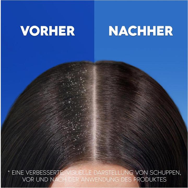 Produktbild Head & Shoulders AppleFresh (500 ml, Flüssiges Shampoo)