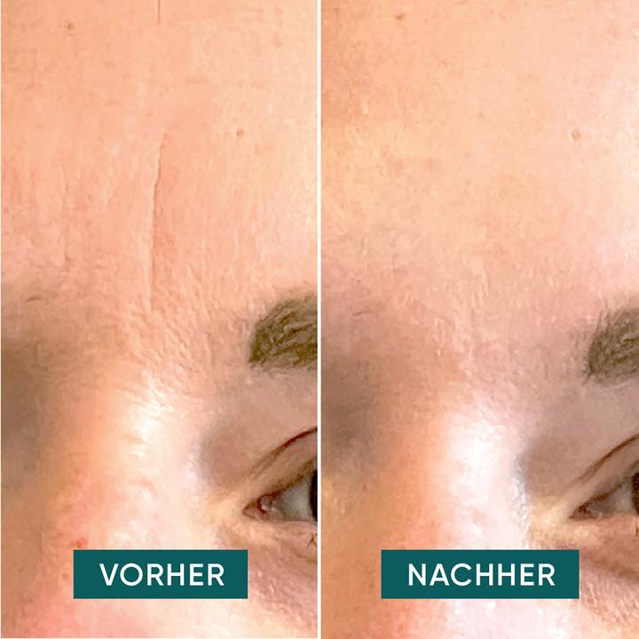 Actual product image Apricot Down The Frown