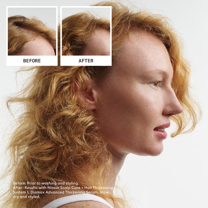 Produktbild Nioxin System 1 Conditioner (300 ml)