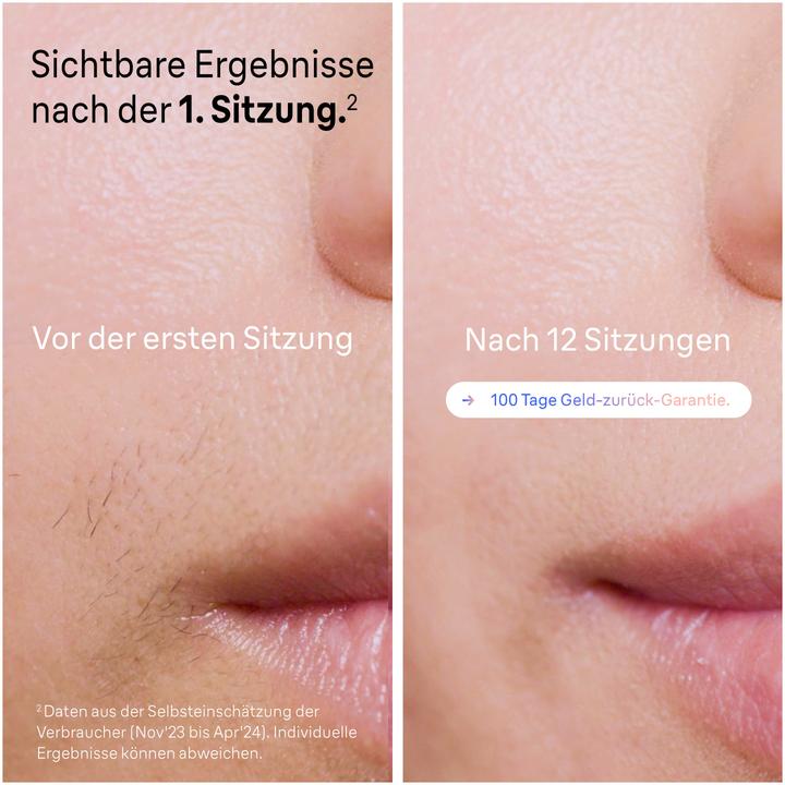 Produktbild Braun Skin i·expert