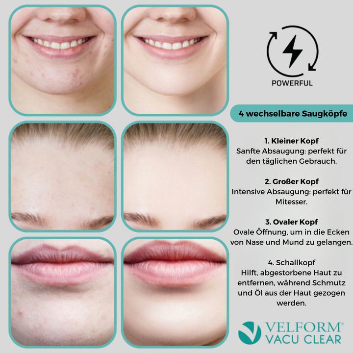 Produktbild Velform Vacu Clear
