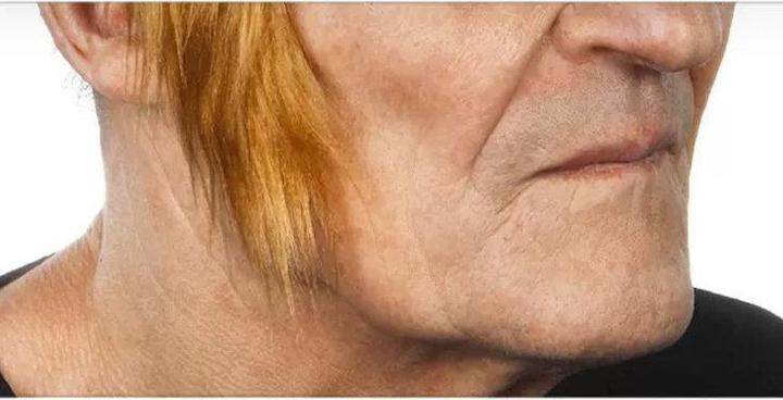 Actual product image Metamorph Koteletten