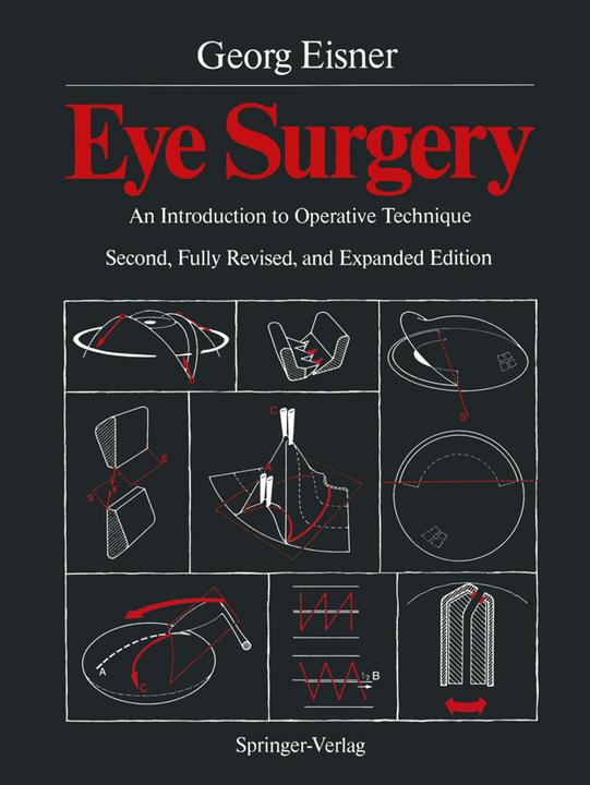 Produktbild Eye Surgery (Englisch, Georg Eisner, 2011)