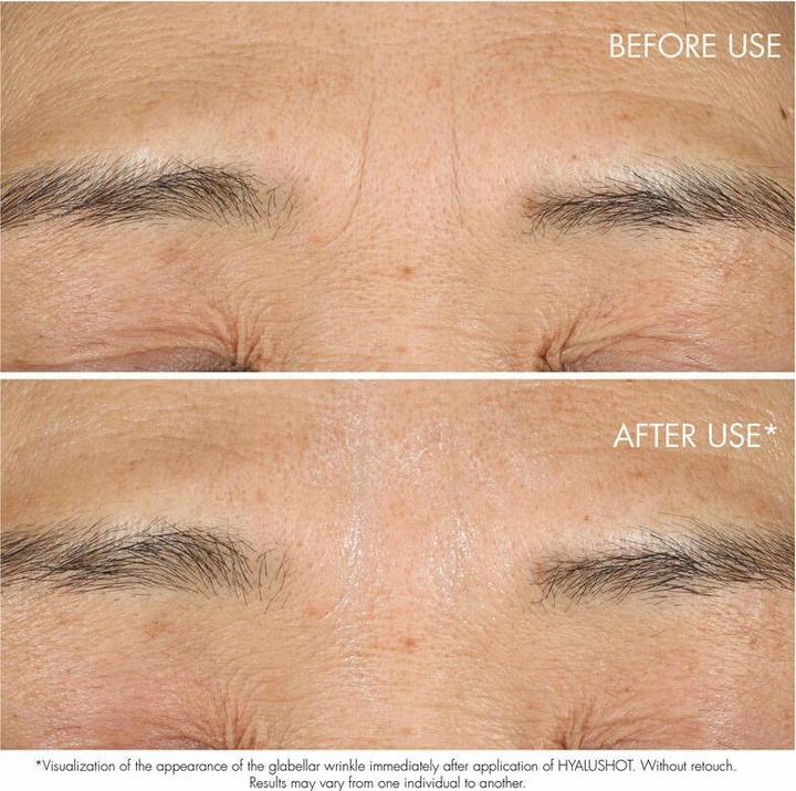 Actual product image Dior Hyalushot Concentre (Serum, 15 ml, Night)