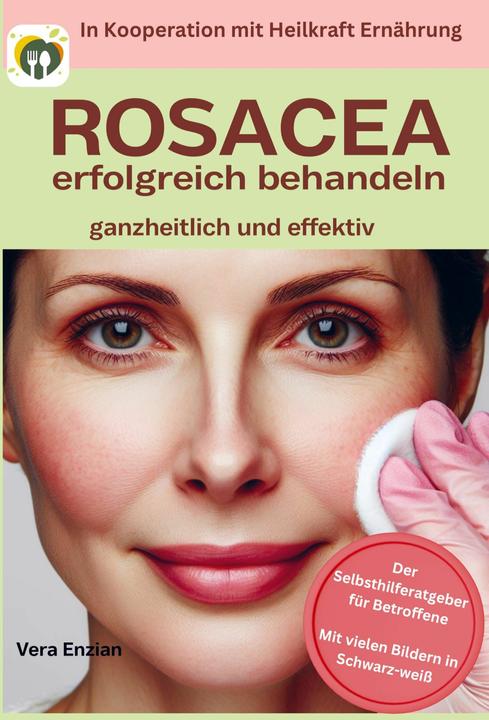 Produktbild Vera Enzian:Rosacea erfolgreich behande (Deutsch, Vera Enzian, 2024)