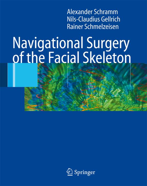 Produktbild Navigational Surgery of the Facial Skeleton (Niederländisch, Rainer Schmelzeisen, Nils-Claudius Gellrich, Alexander Schramm, 2016)