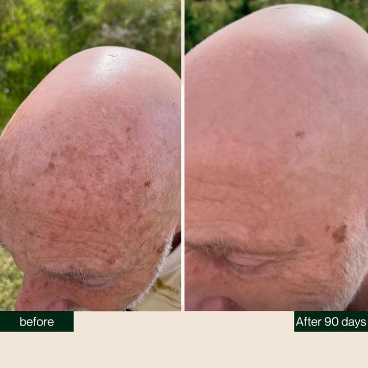 Actual product image Better be bold Bartöl und Glatzenöl - Bald Head & Beard Oil with Diamond Shine-Effect