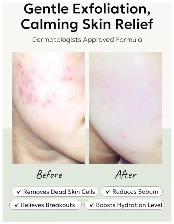 Produktbild Celimax Heartleaf BHA Toner Peeling Pad Koreanische Kosmetik 125ml/4.22 fl.oz (Peeling, 125 ml)