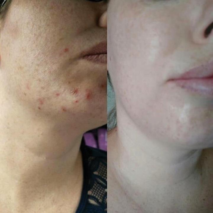Immagine prodotto Eco by Sonya Super Citrus Gel Cleanser - Detergente profondo e rigeneratore della pelle del viso (Gel)