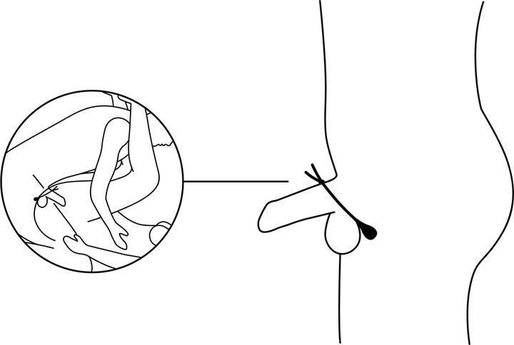 Actual product image Nexus Forge Vibrations Lasso Penisring (4 cm)
