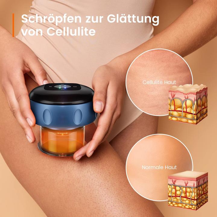 Produktbild Rimba Elektro Schröpfsauger