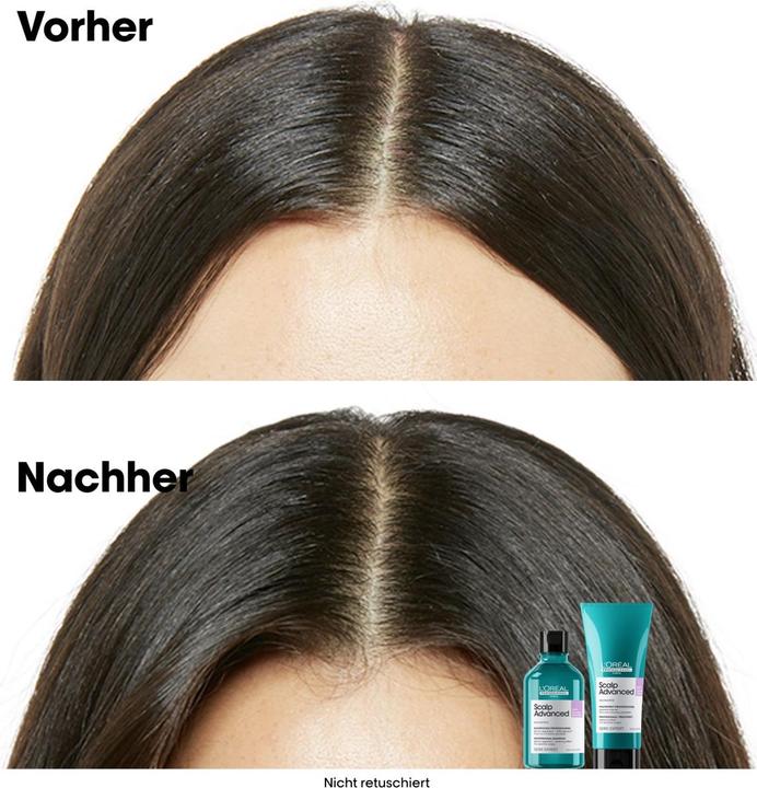 Image du produit L'Oréal Professionnel Série Expert Scalp Advanced - Anti-Discomfort Dermo-régulateur (300 ml, Shampoing liquide)