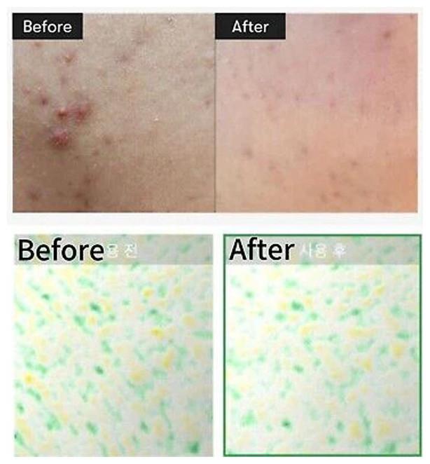 Produktbild VT Cosmetics Reedle Shot 100 (50 ml)