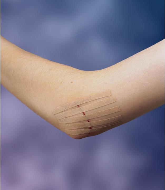 Produktbild Nexcare Steri-Strip Wundverschlussstreifen (6 x)