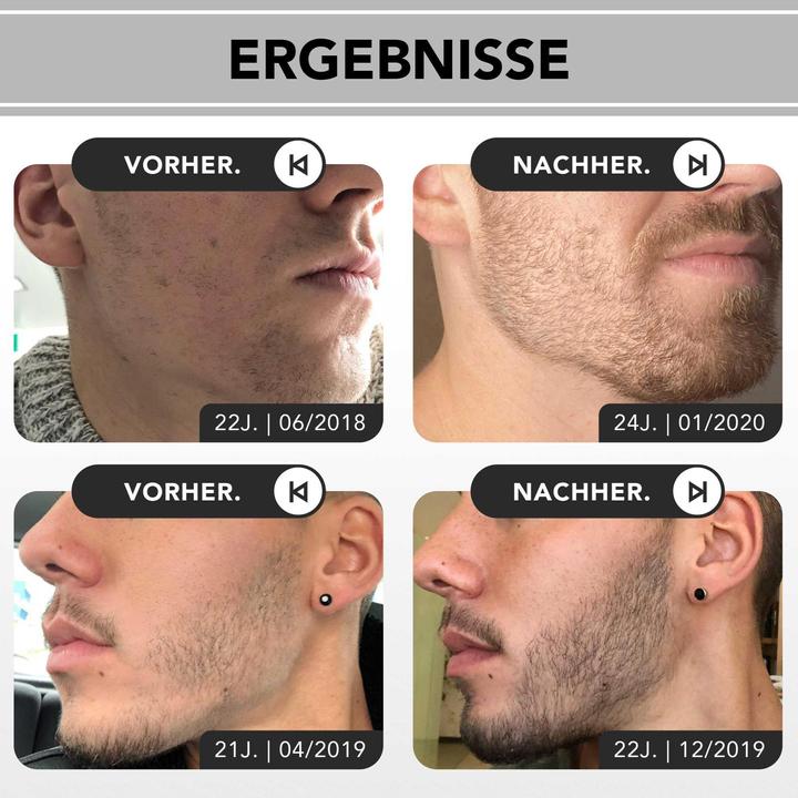 Image du produit Anthony Brown Kit de croissance de la barbe (75 ml)
