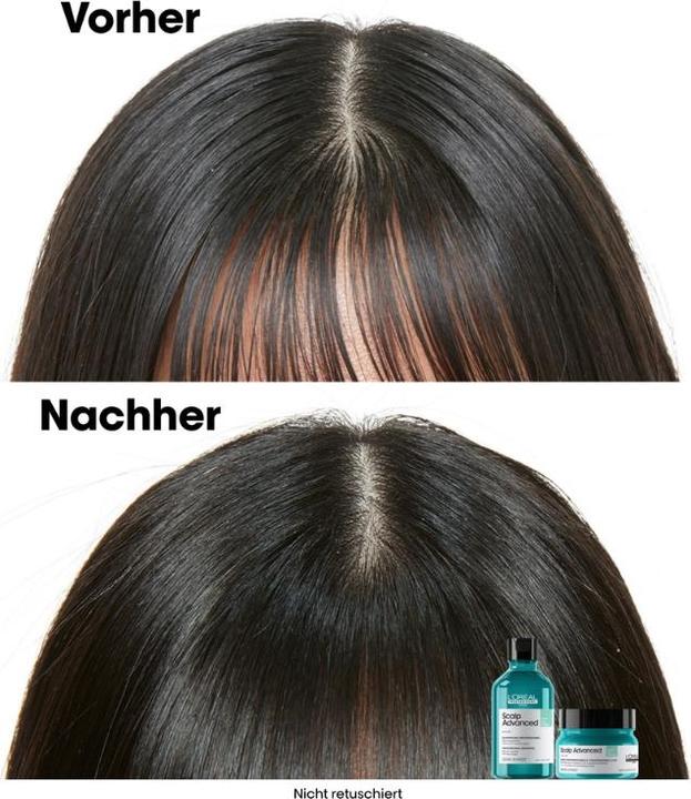 Immagine prodotto L'Oréal Professionnel Scalp Advanced (250 ml)