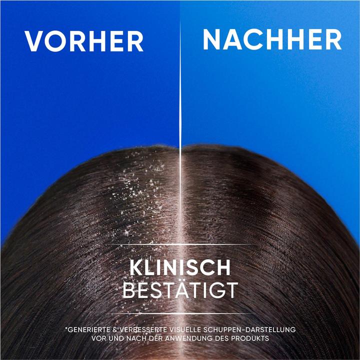 Produktbild Head & Shoulders Anti-Schuppen Shampoo 2in1, apple fresh Shampoo (800 ml, Flüssiges Shampoo)