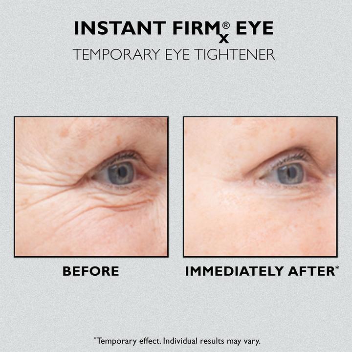 Actual product image Peter Thomas Roth Instant Firmx Eye (Gel, 30 ml)