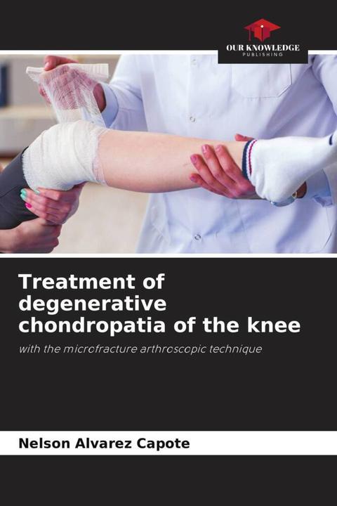 Produktbild Treatment of degenerative chondropatia of the knee (Deutsch, Nelson Alvarez Capote, 2024)
