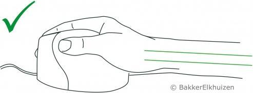 Actual product image Bakker Elkhuizen Evoluent Standard (Cable)