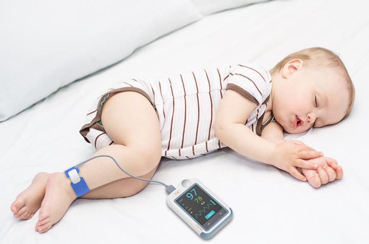 Produktbild ViatomTech Checkme Lite F5 - ECG+SpO2+TEMP Monitor