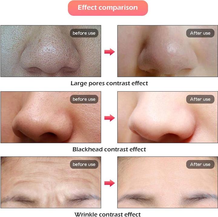 Image du produit Deciniee Masque de luminothérapie