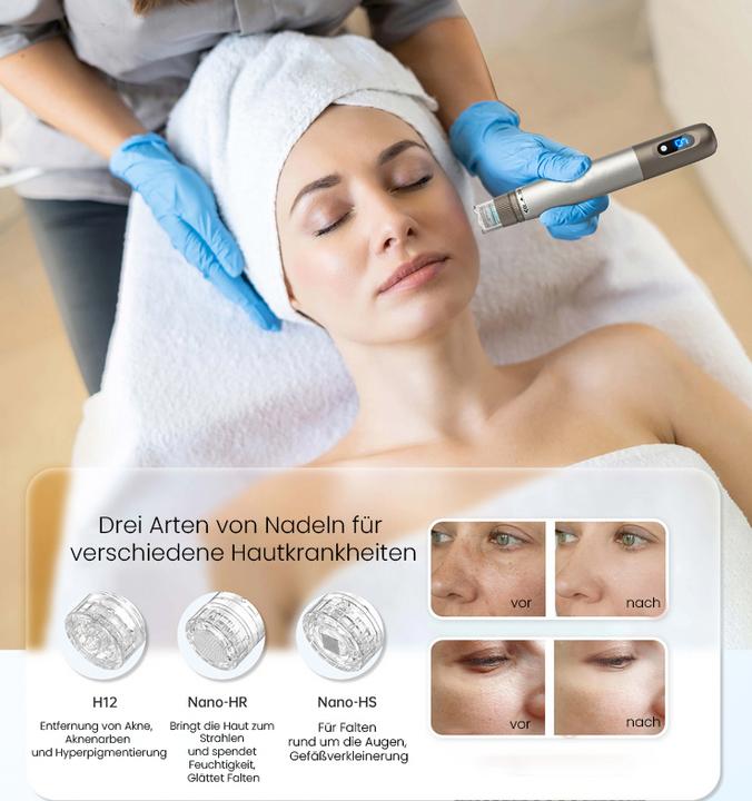 Produktbild Beautifly SkinRenew Pro Dermapen