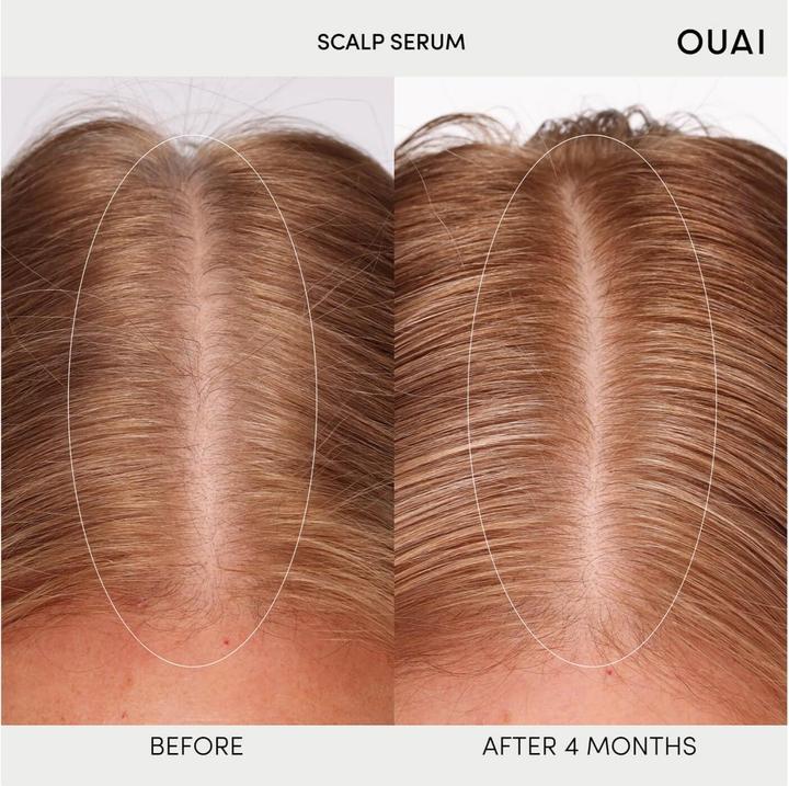 Immagine prodotto Ouai Siero per il cuoio capelluto (60 ml)
