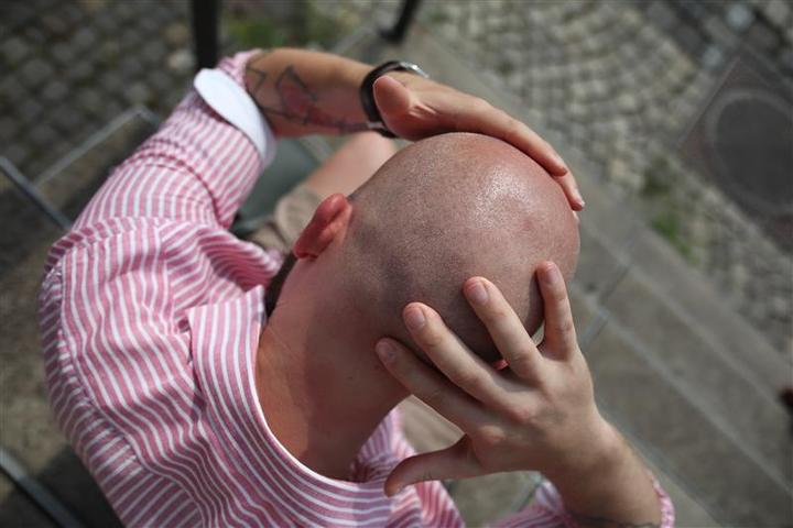 Actual product image Better be bold Sun fluid- Sun cream for bald head and face (Sun cream face, SPF 30, 50 ml)