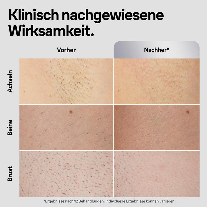 Actual product image Braun Silk·expert Pro 5
