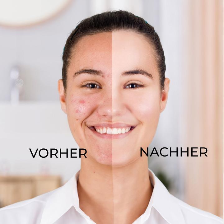 Image du produit Hermex Élimination des points noirs Soin du visage (Nettoyant anti-impuretés)