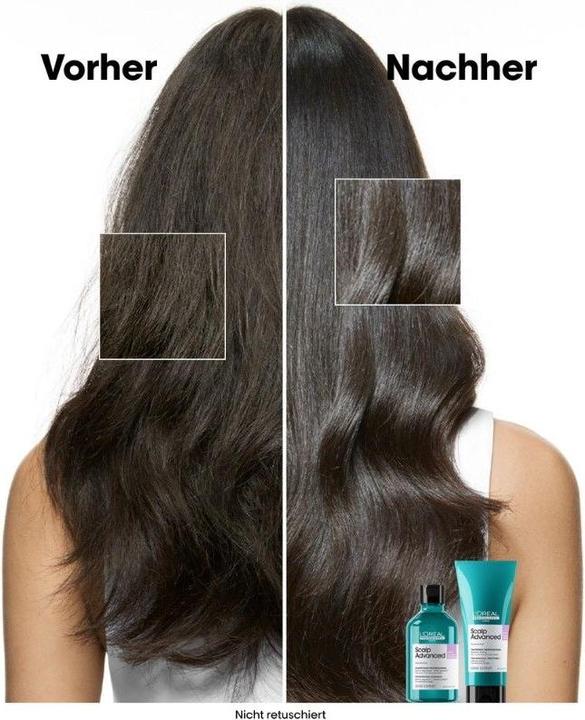Image du produit L'Oréal Professionnel Série Expert Scalp Advanced - Anti-Discomfort Dermo-régulateur (300 ml, Shampoing liquide)