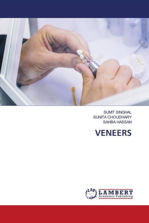Produktbild Veneers (Deutsch, Sahba Hassan, SUMIT SINGHAL, Sunita Choudhary, 2024)