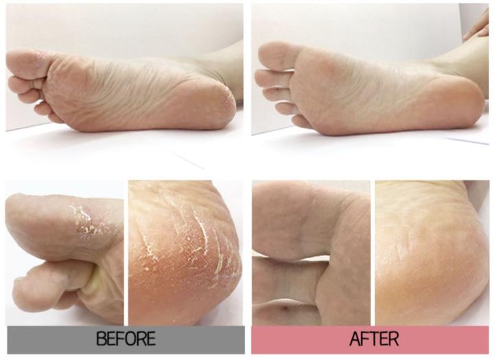 Produktbild Holika Holika BABY Silky Foot One Shot Peeling (Fussmaske, 20 ml)