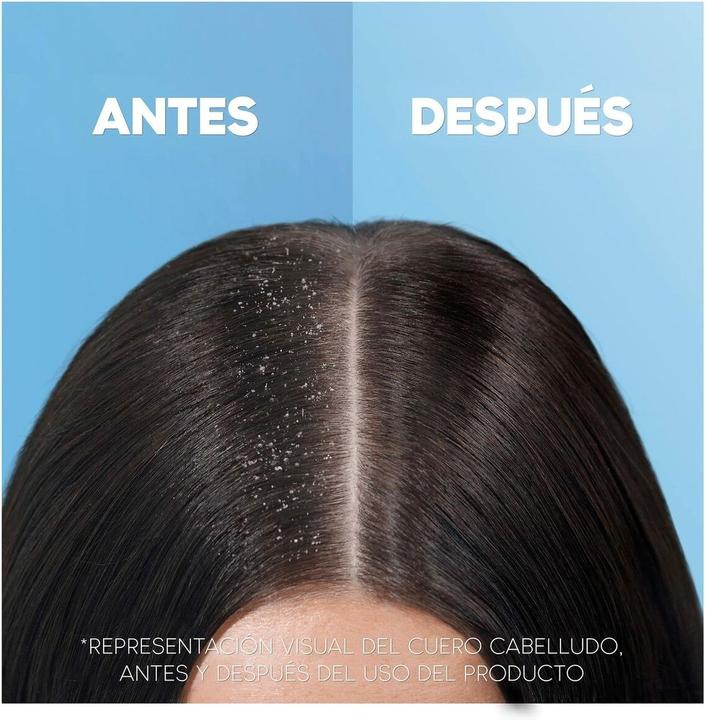 Produktbild Head & Shoulders 2-in-1 Classic (1000 ml, Flüssiges Shampoo)