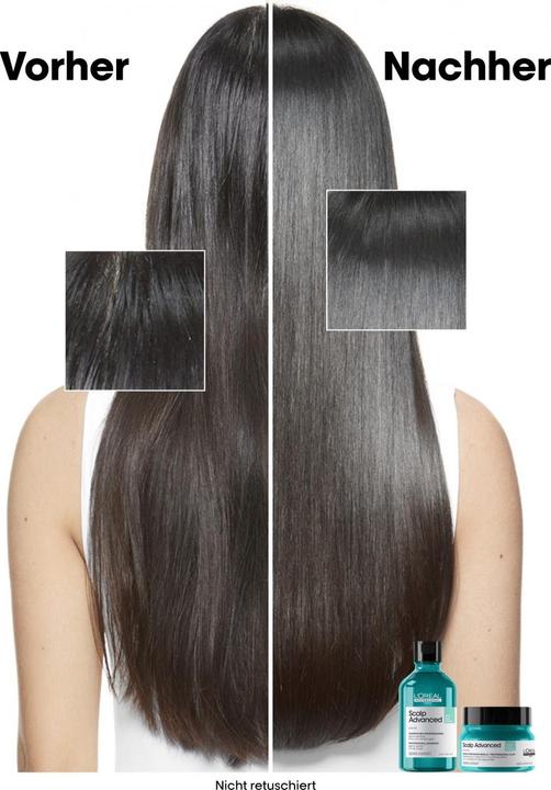Immagine prodotto L'Oréal Professionnel Scalp Advanced (250 ml)