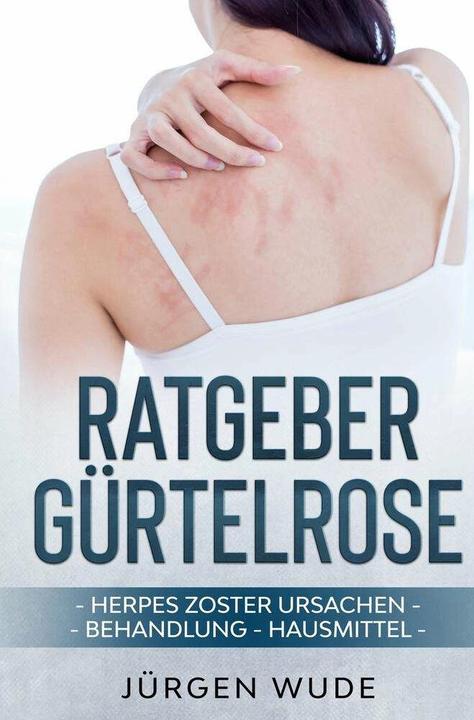 Produktbild tolino Ratgeber Gürtelrose (Deutsch, Jürgen Wude, 2023)