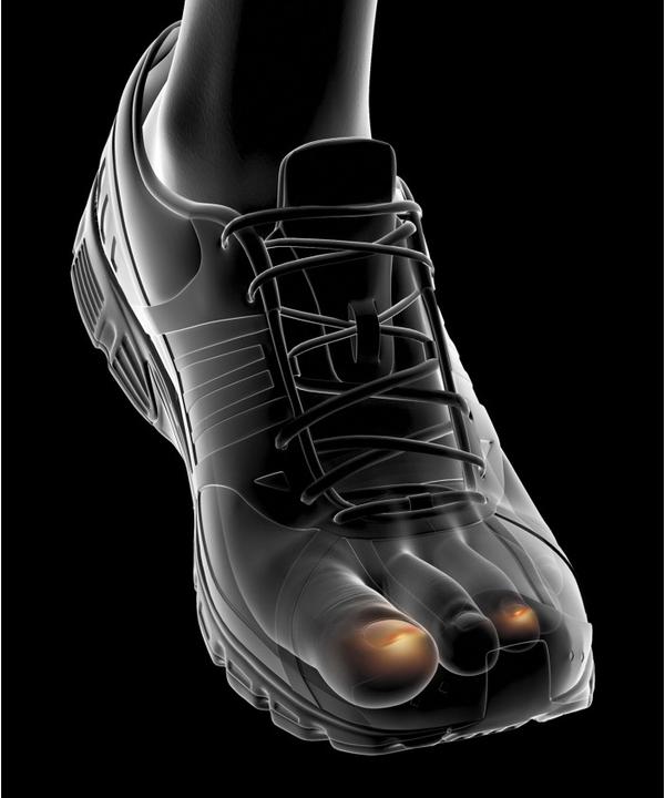 Image du produit Epitact Capuchons de protection pour le sport ongles bleus EpitheliumTact 02, taille M 25 mm