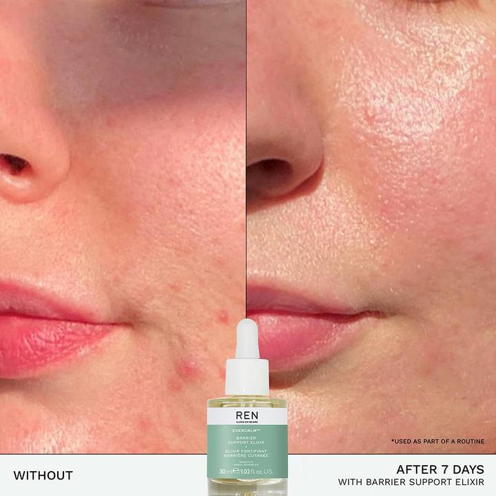 Image du produit Ren Evercalm Barrier Support Elixir 30 ml (30 ml)