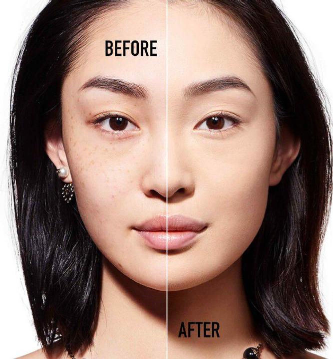 Productafbeelding Dior Diorskin Forever Undercover 24H (031 Zand)