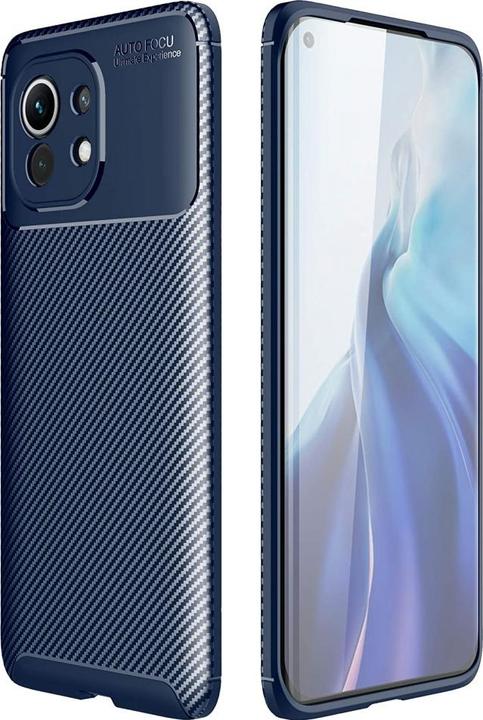 Productafbeelding Screenguard Xiaomi Mi 11 Romp Carbon Design TPU Hoesje (Xiaomi Mi 11i)