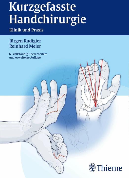 Produktbild Kurzgefasste Handchirurgie (Deutsch, Reinhard Meier, Jürgen Rudigier, 2014)