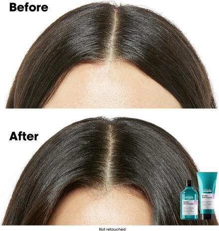 Actual product image L'Oréal Professionnel Series Expert Scalp Advanced Anti-Discomfort Dermo-Regulator Refill (500 ml, Liquid shampoo)